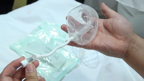 ใส่บอลลูน ในกระเพาะอาหาร อีกหนึ่งวิธีลดอ้วนให้ได้ผล