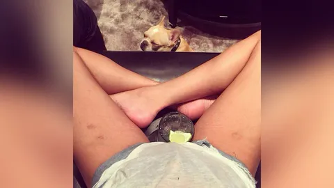 นางแบบลูกครึ่ง'ไทย-นอร์เวย์'ชื่อดัง โพสต์ภาพขามีรอยช้ำลงอินสตาแกรม