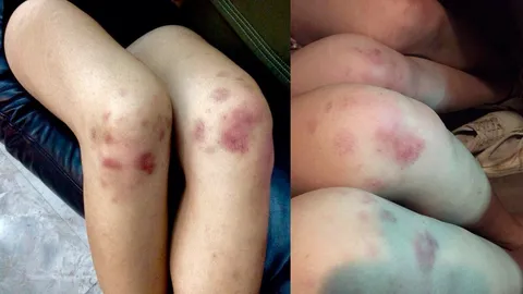 นักเรียนโวย! เข้าค่ายอาสา ม.ดัง กลายเป็นกิจกรรมรับน้องสุดโหด