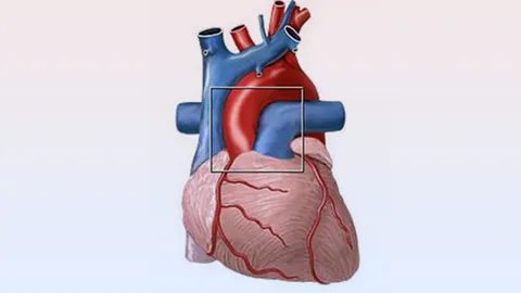 ซ่อม "ลิ้นหัวใจรูมาติก" ด้วย..เยื่อหุ้มหัวใจ