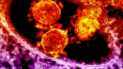 สคร. 5 โคราช ยันไม่พบผู้ป่วยเมอร์สที่ บุรีรัมย์-ชัยภูมิ