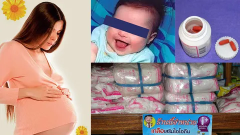 ป้องกัน...โรคเอ๋อ เสริม "ไอโอดีนเม็ด" ในหญิงตั้งครรภ์