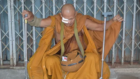 จับสึกพระ แกล้งตาเจ็บ-ขาเป๋ เรี่ยไรเงินชาวบ้าน