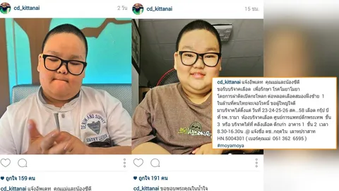 แม่โพสต์ไอจี วอนช่วยเหลือ 'น้องซีดี' ตุ๊กแกรักแป้งมาก ป่วยโรคโมยาโมยา