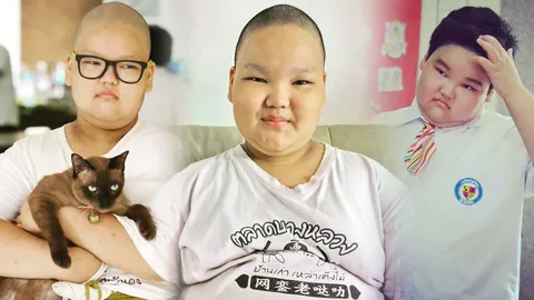 แม่เผยเสี่ยงอัมพาต! 'น้องซีดี ตุ๊กแกรักแป้งมาก' ใจสู้! หลังผ่าตัดหนูต้องฟื้น!