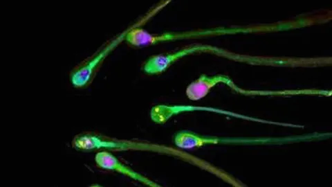 สร้างเชื้ออสุจิ ขึ้นในหลอดแก้ว
