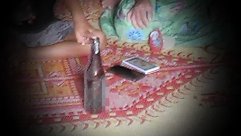 ด.ช. 6 ขวบ จุดประทัดลงขวด ระเบิดเข้าตาด้านขวา หวิดบอด! 