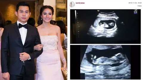 วันนี้ที่รอคอย!! หลุยส์ เฮ กระแต ท้อง 3 เดือน 