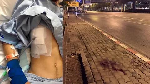 เตือนภัย! หนุ่มร้องถูกแท็กซี่ฟัน หลังติงเรื่องเปิดไฟว่างแล้วไม่รับคน