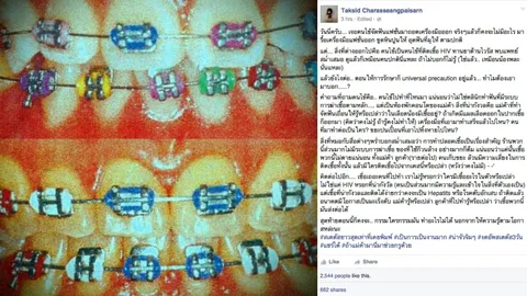 หมอฟันเล่าเรื่องสุดช็อก! แม่ค้าจัดฟันเถื่อนรู้มั้ย? ลูกค้าของคุณติดเชื้อ HIV