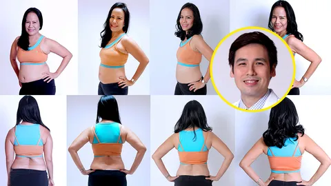 ใส่ "บอลลูน" ในกระเพาะอาหาร นวัตกรรมลดอ้วน