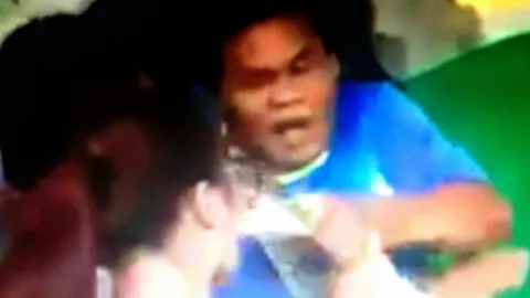 วินาทีระทึก! งูเหลือมโชว์ฉกจมูก-ปาก นทท.สาวชาวจีนบาดเจ็บ