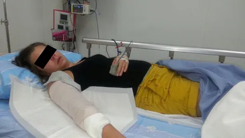 คนร้ายกระชากกระเป๋าแหม่มฟินแลนด์ เหยื่อฮึดสู้ถูกมีดกรีดแขนเหวอะ