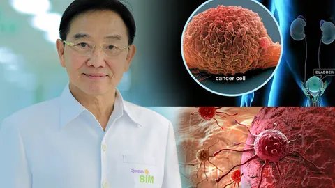 4 กุมภาพันธ์ “วันมะเร็งโลก” รณรงค์เตรียมร่างกายให้พร้อมต่อกรกับโรคภัย