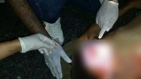 คดีสุดแปลก กิ่งสนตกเสียบอกตาย! ทนายชี้ไม่ใช่ความซวย แต่เข้าข่ายละเมิด