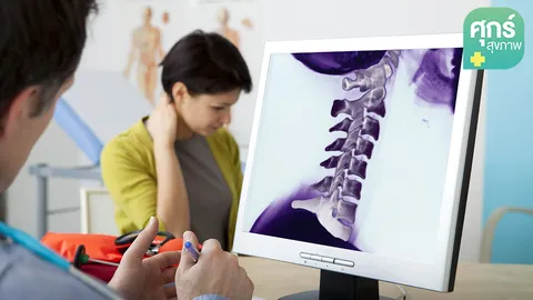 โรคกระดูกคอเสื่อม ตอนที่ 2