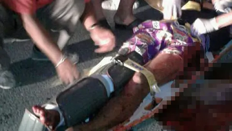 แก้แค้นแทนพ่อ! พี่น้องสองโจ๋ ไล่ปาระเบิดพลทหาร ขาขาดคาถนน