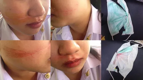 ชาวเน็ตเตือนภัย ‘หาดใหญ่-สงขลา’  มีเส้นเอ็นขึงขวางถนนกลางวันแสกๆ