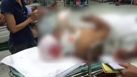 สาวใหญ่ขับรถหลับใน พุ่งชน กระบะรองผกก.โนนสุวรรณ บาดเจ็บสลบคารถ