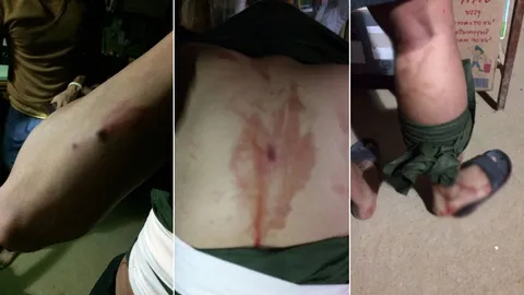 คนร้ายลอบยิงถล่มฐานทหารที่ อ.บันนังสตา จนท.เจ็บ 1 นาย