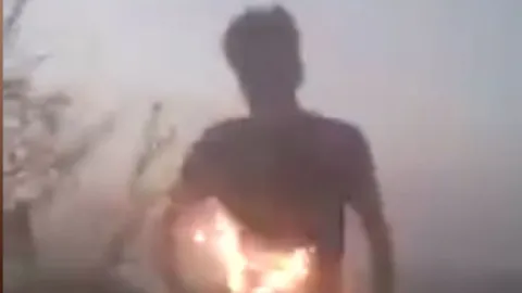 สลด! หนุ่มอินเดียจุดไฟเผาตัวเองเลียนแบบ 'ก็อต ทาเลนต์' พลาดดับอนาถ