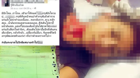 สาวฮอนด้าโพสต์โดนตำรวจขว้างไฟฉายใส่หัวที่แท้ซ้อน จยย.แหกด่าน