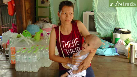 ผู้ใจบุญแห่ยื่นมือเข้าช่วยเด็กพิการที่สกลฯ หัวโต ตามองไม่เห็น 