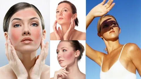 รับมือกับสภาพอากาศองศาเดือด ผิวซันเบิร์นหมดปัญหา...กู้คืนได้