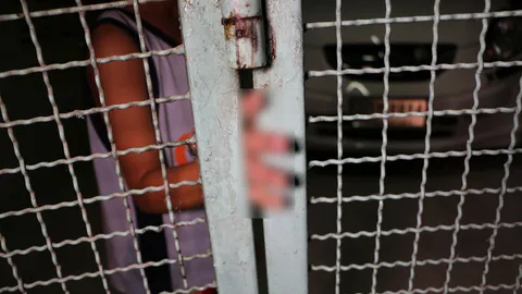 อุทาหรณ์พ่อแม่! เด็กน้อยเล่นซน ประตูรั้วเหล็กหนีบมือ ดึงไม่ออก