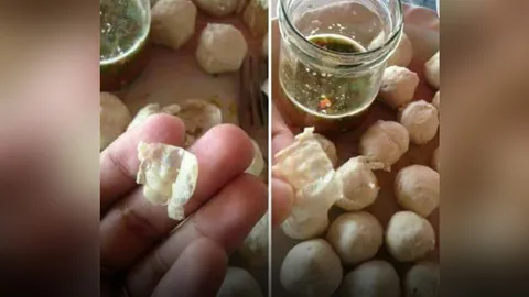 สาวโพสต์เฟซบุ๊ก อ้างเจอหนังงูในลูกชิ้นหมู ชาวเน็ตถกเดือด มองเป็นหนังตีนไก่