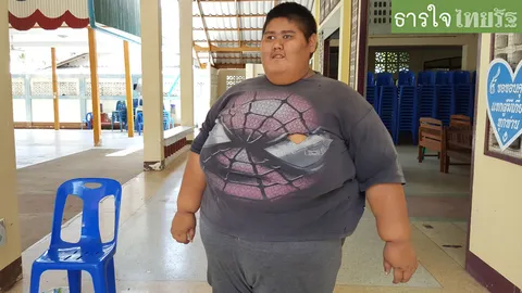 วอนช่วย 'น้องเก่ง' วัย 22 พัฒนาการช้า หนัก 200 กก. ต้องใช้ชีวิตลำบาก