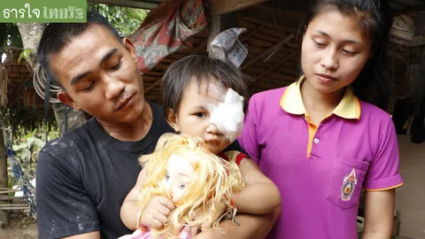 ยอดเงิน 3 วัน ช่วย 'น้องแป้ง' พุ่ง 1.4 ล้าน คาด 2 เดือนใส่ตาปลอม