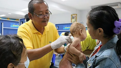 นายกเล็กจิตอาสารักษาฟรี “โรคสะเก็ดเงิน”