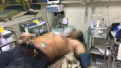 2 วัยรุ่นโหด! ถามเรียนที่ไหน ก่อนคว้ามีดแทงโจ๋ นศ.กรุงเทพช่างเจ็บสาหัส