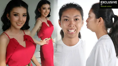 ขอบคุณปาฏิหาริย์! เปลือยชีวิตสาวไร้คางแก้วหน้าม้า ‘ฝน จิตราภรณ์’