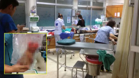 แก๊งโจ๋ฟันหนุ่มอุดรฯ มือขาด! กัดฟันหยิบจากพื้น บึ่ง จยย.ให้หมอต่อ