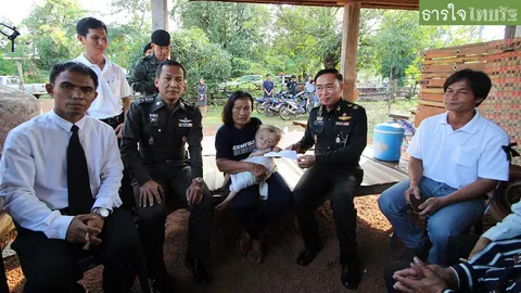 ช่วยเด็กป่วยหัวโต "ถวายพ่อหลวง"