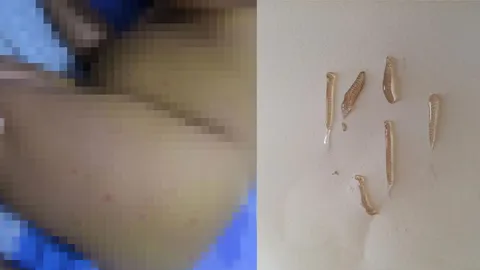 อ.เจษฎา ไขคำตอบ! แม่เจอตัวประหลาดในกะละมัง ทำลูกน้อยเป็นผืนแดง