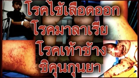 MosQ Eco Trap ชวนปกป้องคนที่คุณรัก ให้ห่างไกลโรคร้ายที่มาจากยุง