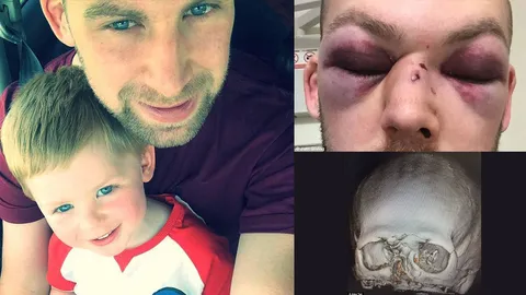 ช็อก! นักคริกเกต ลูกน้อยกำลังเกิด กระดูกใบหน้าหัก 15 ชิ้น ส่อหมดอนาคต