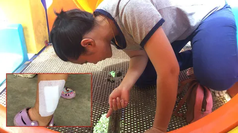 กลัวติดบาดทะยัก แม่แจ้งตร.สไลเดอร์ทุ่งท่าลาดเกี่ยวขาลูกเหวอะ สนิมเขรอะ