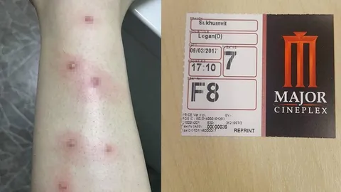 เมเจอร์แจงดราม่า ลูกค้ามีตุ่มหนองขึ้นขา ไม่ใช่เห็บหมัดกัดในโรงหนัง