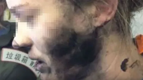 ออสซีเตือนภัยหลังหูฟังระเบิดบนเครื่องบิน