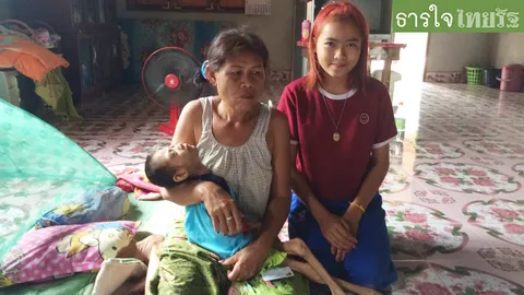 วอนช่วยเด็กหญิงครอบครัวยากจนวัย 14 ป่วยแขนขาลีบ น้ำหนักเพียง 5 กก.