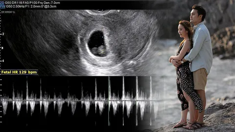 'เตชินท์' หน้าบาน "น้ำยาแรง" 'หลิน' เมียรักท้องเกือบ 2 ด. เห่อหนักมาก