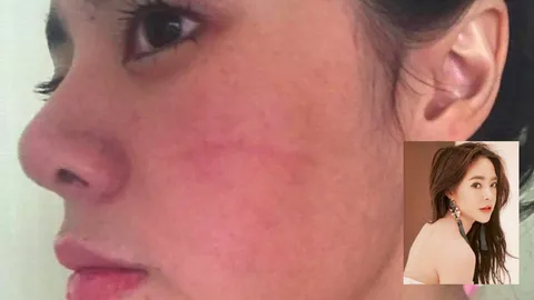 กัสจัง หน้าพัง ถูกผู้ชายทั้งตบ-ทั้งต่อย แต่ไม่ขอแจ้งความ! 