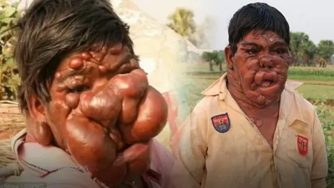 ภาพแรก 6 เดือนผ่าน พลิกชีวิตหนุ่มโรตีหน้าผี