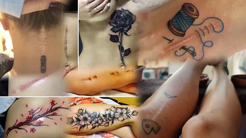 เมื่อรอยแผลกลายเป็นศิลปะ เปิดสุดยอดไอเดียดีสักทับรอยแผลเป็น