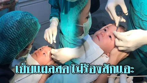 เก่งมากลูก! เปิดใจหัวอกแม่ ลูกหัวแตก เย็บแผลสดไม่ร้อง วิว 5 ล้าน (คลิป)