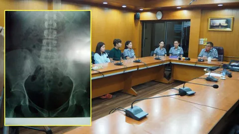 คดีหมอลืมเข็ม! ฝังในมดลูกสาวนาน12 ปีหลังผ่าคลอดบุตร ยังเจรจาไม่ลงตัว 